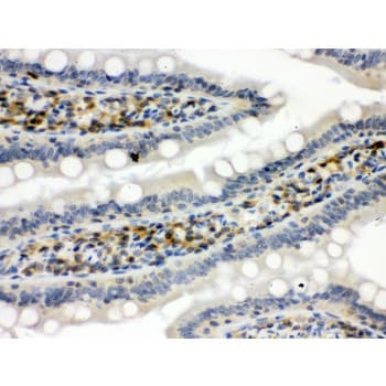 Polyclonal Rabbit anti-Human STAT1 Antibody (aa114-143, IHC, WB)