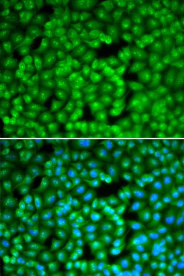 FBL / FIB / Fibrillarin Antibody