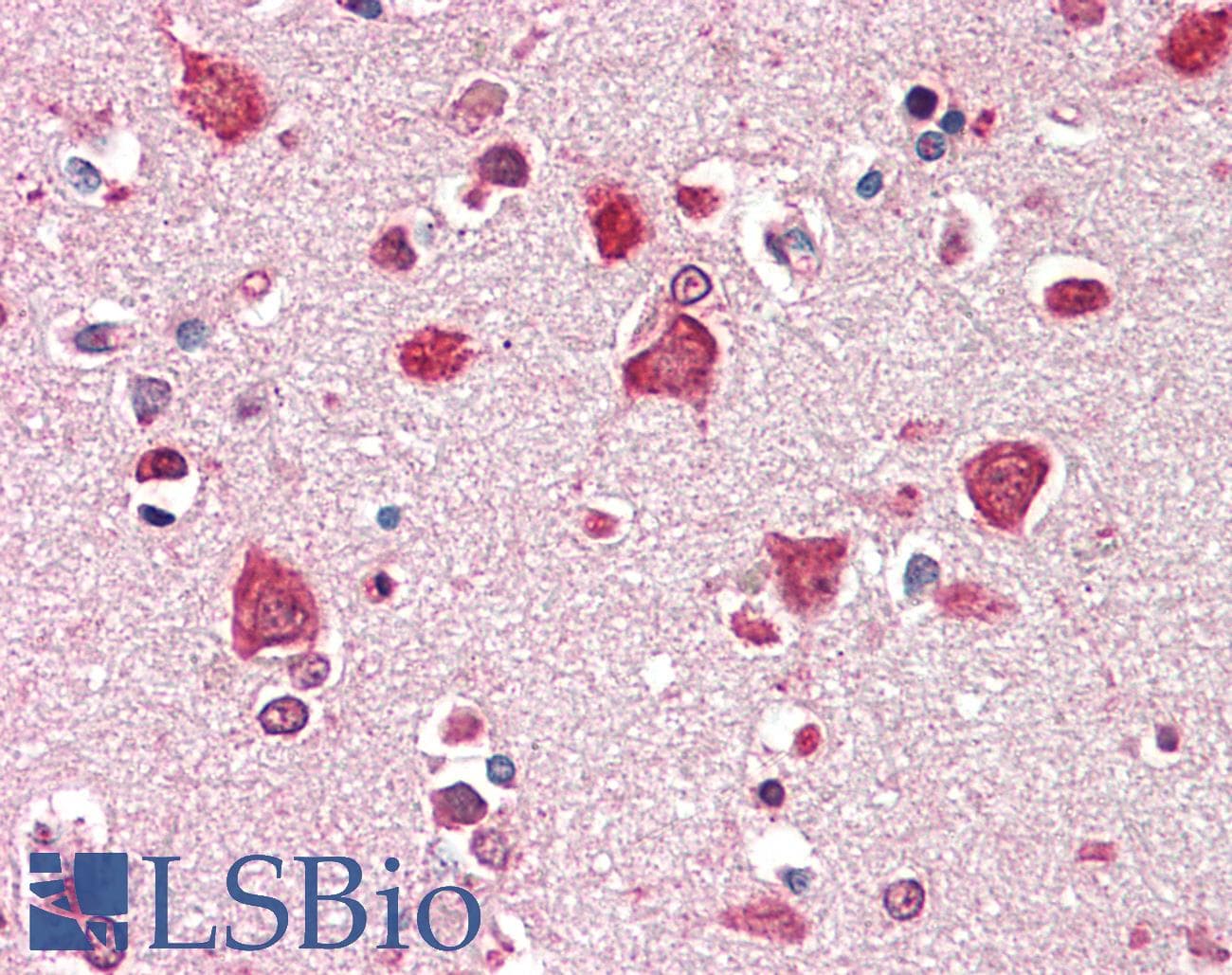 IHC-plus™ Polyclonal Goat anti-Human SDCCAG8 Antibody (aa469-483, IHC)
