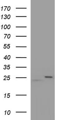 RAB21 Antibody (clone OTI6G3)