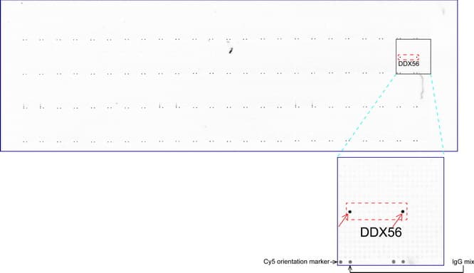 DDX56 Antibody (aa323-547, clone UMAB153)