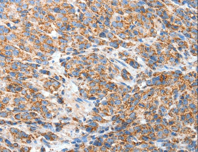 BAK1 / BAK Antibody