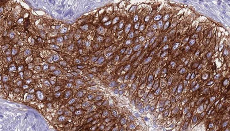 Polyclonal Rabbit anti-Human ADORA2A/Adenosine A2A Receptor Antibody (IHC, IF, WB)