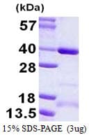 Human CCDC101 Protein (Recombinant His)