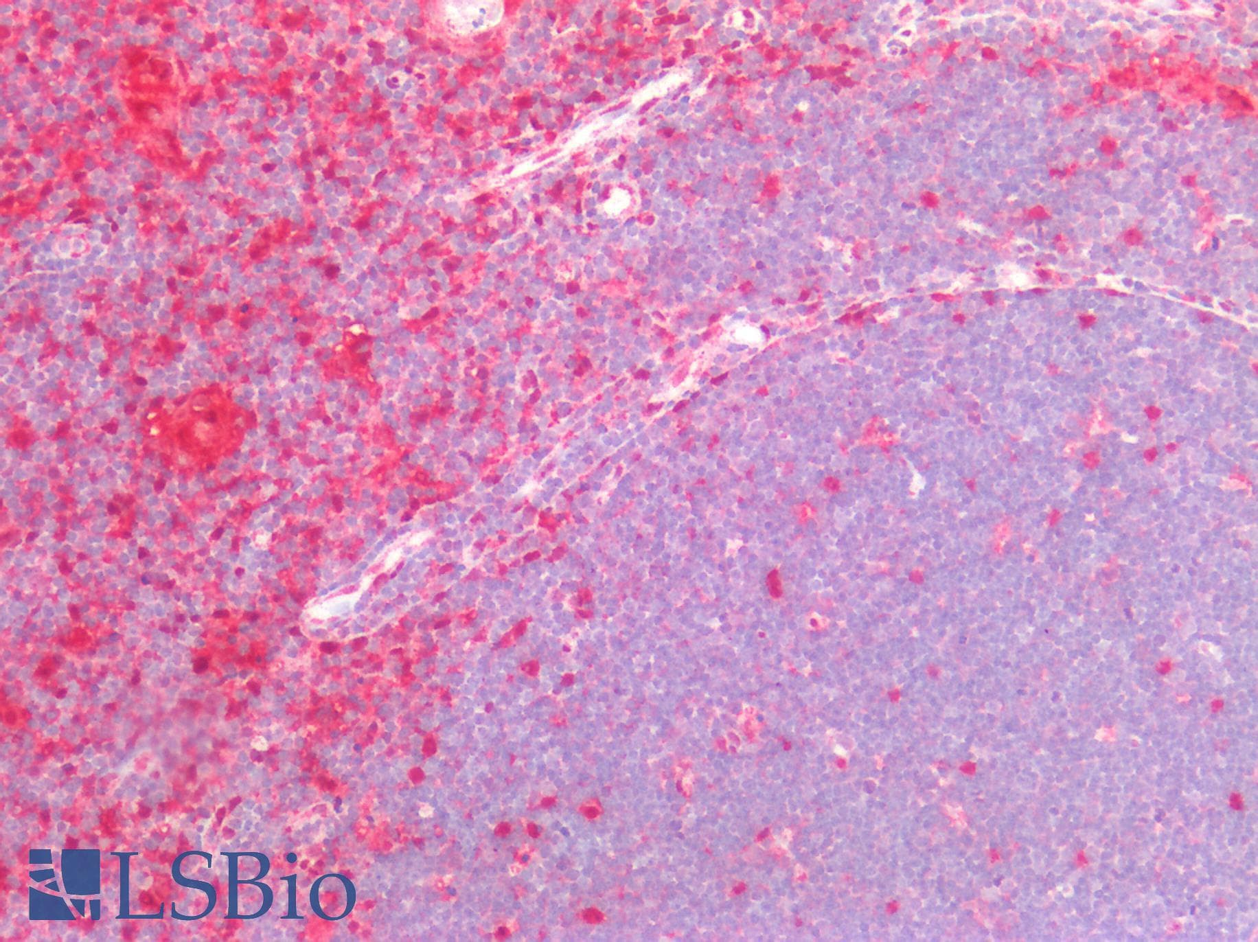 PathPlus™ TP / Thymidine Phosphorylase Antibody (clone 7A6)