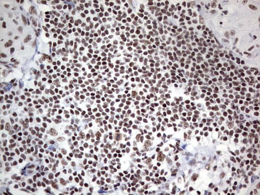 HDAC9 Antibody (aa181-460, clone OTI7G2, Carrier-free)