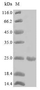 Alnus glutinosa Major pollen allergen Aln g 1 Protein (Recombinant 6His, N-terminus)