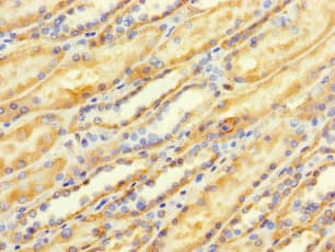 TMEM184B Antibody