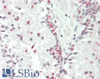 IHC-plus™ BAK1 / BAK Antibody (aa56-91)