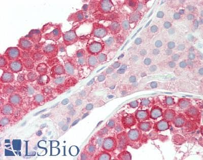 IHC-plus™ Polyclonal Goat anti-Human RENT1 / UPF1 Antibody (aa1075-C-term, IHC, WB)