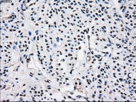 Monoclonal Mouse anti-Human PSMD10 / Gankyrin Antibody (clone OTI3F6, WB)