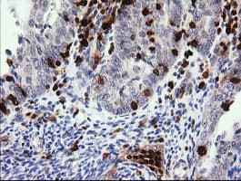PIK3CG / PI3K Gamma Antibody (clone OTI4D3)