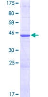 Human RTKN2 Protein (Recombinant GST)