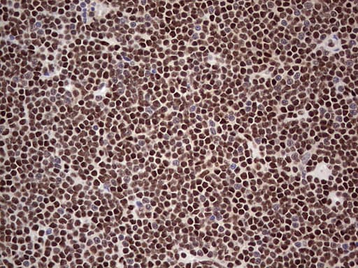 SAE1 Antibody (clone OTI3C3)
