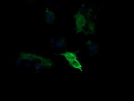 MAP2K1 / MKK1 / MEK1 Antibody (clone OTI3B4, Carrier-free)