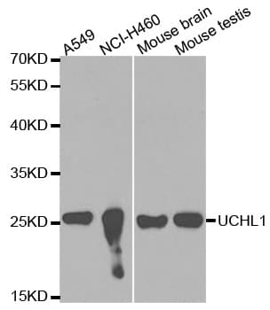 UCHL1 / PGP9.5 Antibody