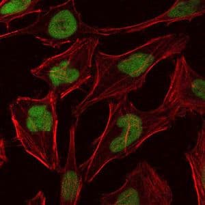 MCM2 Antibody (clone 10000000)