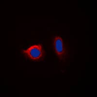 CANX / Calnexin Antibody (phospho-Ser583)