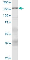 Monoclonal Mouse anti-Human ASXL1 Antibody (clone 6E2, WB)