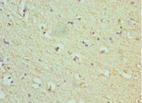 SEPT7 / Septin 7 Antibody (aa308-437)