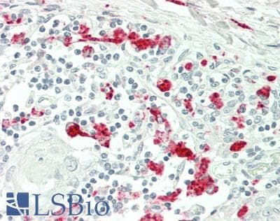 IHC-plus™ RAB8B Antibody (C-Terminus)