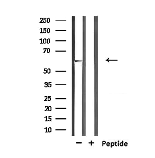 Polyclonal Rabbit anti-Human ZNF280B Antibody (IHC, WB)