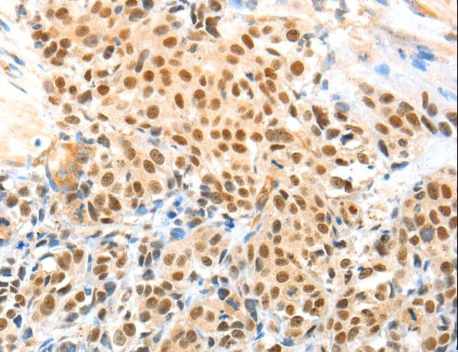 APPL1 / APPL Antibody