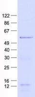 Human ATF2 Protein (Recombinant His, N-Terminal)