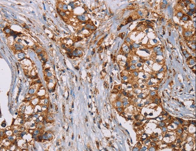 NDUFS1 Antibody