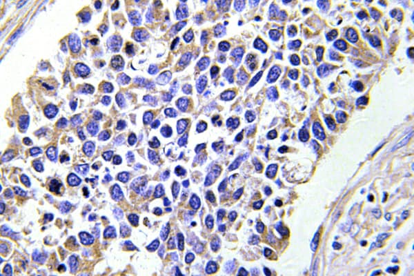 Polyclonal Rabbit anti-Human AKR1B1 / Aldose Reductase Antibody (Lys275, IHC, IF, WB)