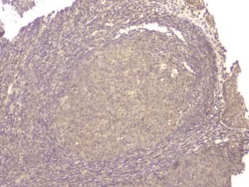 Polyclonal Rabbit anti-Human BMP15 Antibody (IHC, WB)