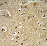 IGF1R / IGF1 Receptor Antibody (aa51-77)