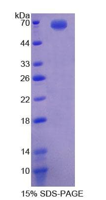 Human E2F2 Protein (Recombinant His-GST)