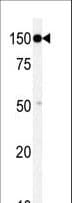 Polyclonal Rabbit anti-Human TAOK1 / TAO1 Antibody (aa620-650, WB)