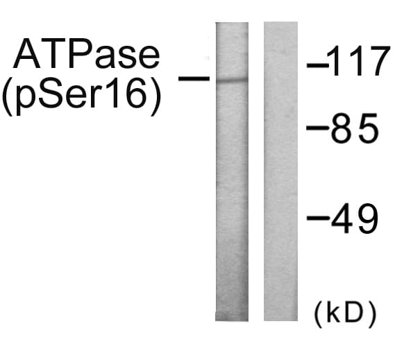 Polyclonal Rabbit anti-Human ATP1A1 Antibody (phospho-Ser16, IHC, WB)