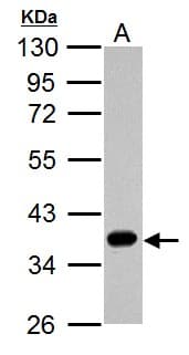 ARG1 / Arginase 1 Antibody (aa1-322)