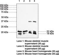 IHC-plus™ CAV3 / Caveolin 3 Antibody (aa19-41)