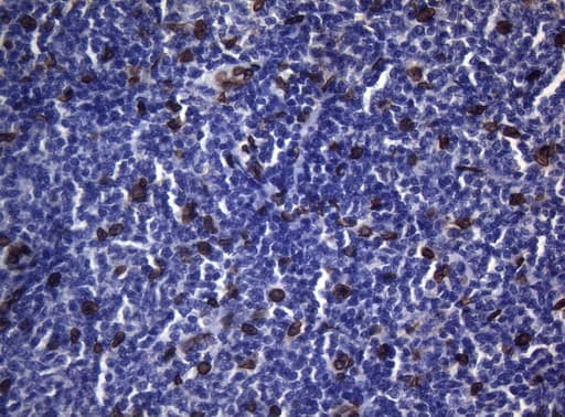 BCL6 Antibody (aa1-300, clone OTI1C3, Carrier-free)