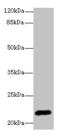 EPO / Erythropoietin Antibody