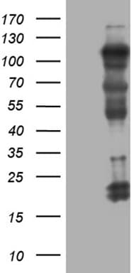 NIRF / UHRF2 Antibody (aa1-288, clone OTI4E10)