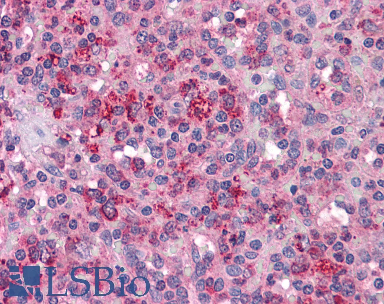 IHC-plus™ Polyclonal Rabbit anti-Human PAK1 Antibody (IHC, WB)
