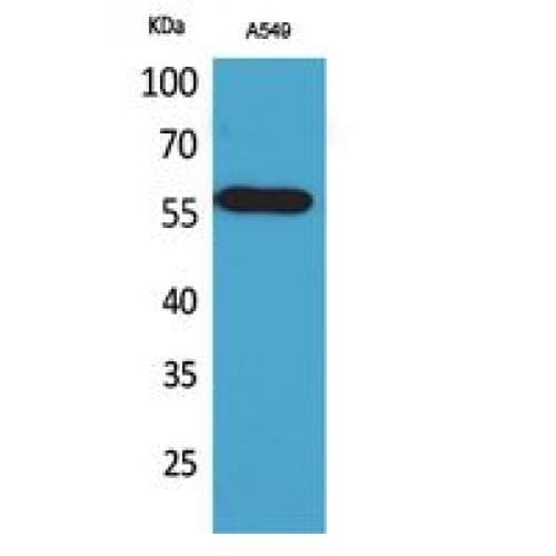 IHC-plus™ ALDH2 Antibody (41-90 aa, N-terminal)