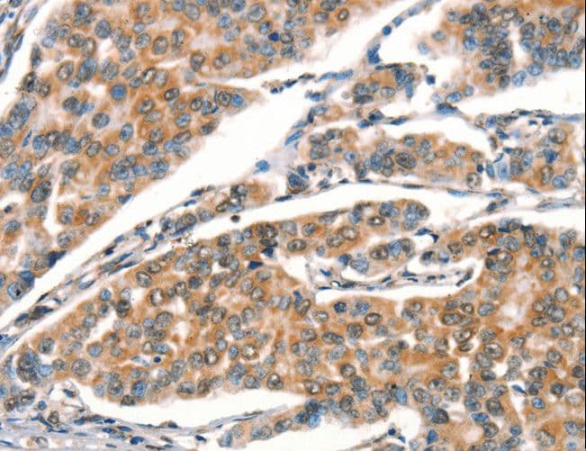 DRAK1 / STK17A Antibody
