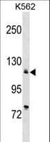 ATP2A2 / SERCA2 Antibody (aa374-403)