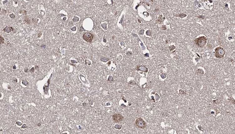 Polyclonal Rabbit anti-Human GDI1 Antibody (IHC, IF, WB)