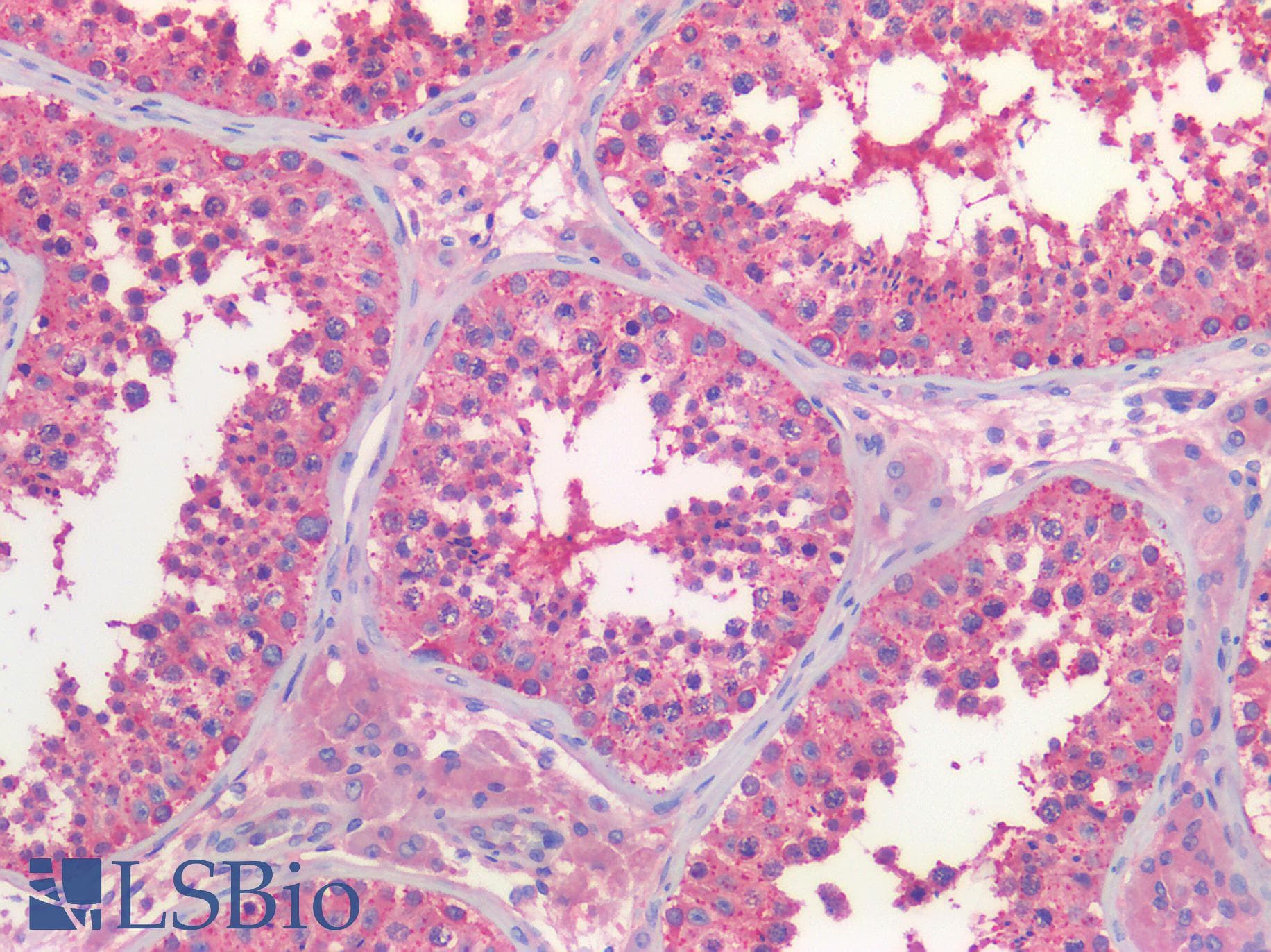 IHC-plus™ Polyclonal Rabbit anti-Human GARS / Glycyl tRNA Synthetase Antibody (IHC, IF, WB)