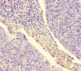 ARAF / ARAF1 / A-RAF Antibody