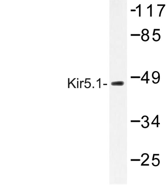 IHC-plus™ Polyclonal Rabbit anti-Human KCNJ16 / Kir5.1 Antibody (aa376-428, IHC, IF, WB)