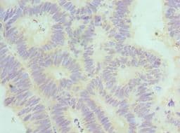 Polyclonal Rabbit anti-Human SF3B2 Antibody (aa616-895, IHC)