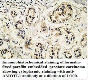 Polyclonal Rabbit anti-Human JEAP / AMOTL1 Antibody (C-Terminus, IHC, WB)